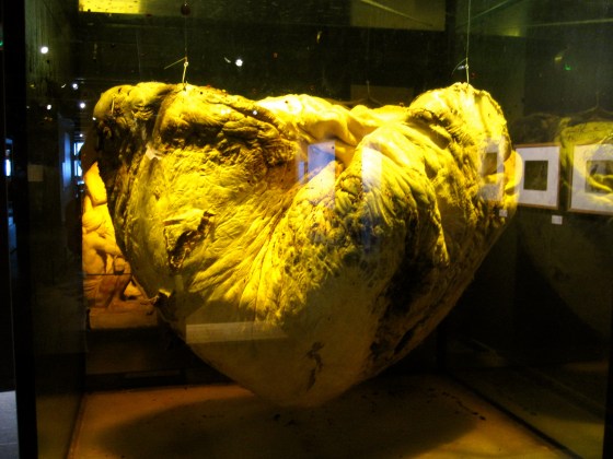 Whale heart
